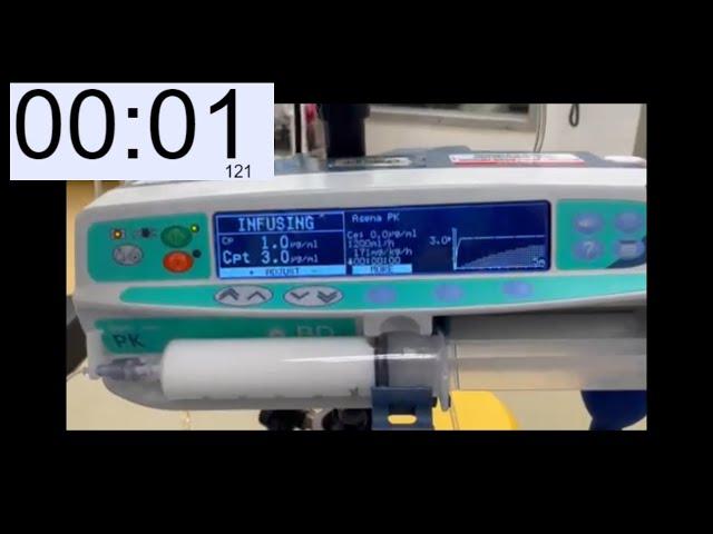 Inducing anesthesia with a TCI pump