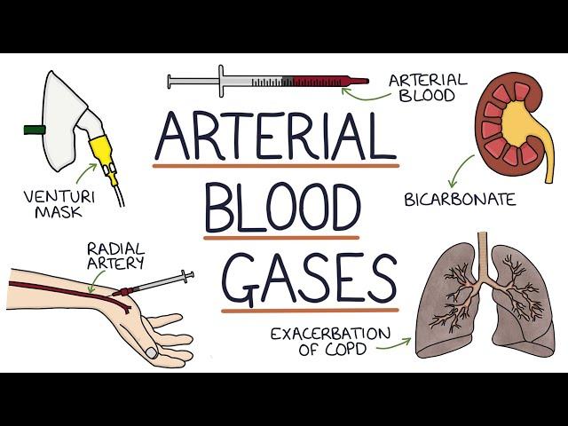 Understanding Arterial Blood Gases