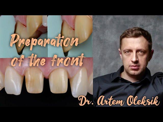 Lesson of preparation of front teeth. Temporary crusts. Dr. Artem Oleksik.