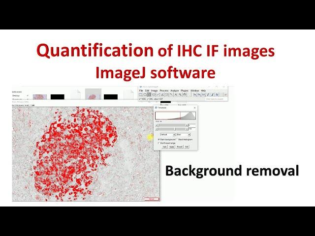 Quantification of Immunohistochemistry images using ImageJ | How to remove background in ImageJ