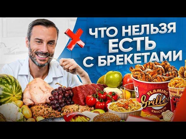 НЕ ЕШЬ ЭТО с брекетами! 10 запрещенных продуктов