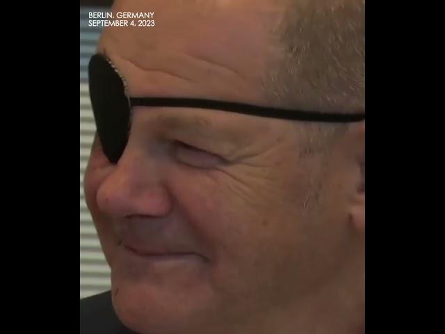 German Chancellor 'Pirate Olaf' Scholz appears at Congress wearing eyepatch after jogging accident