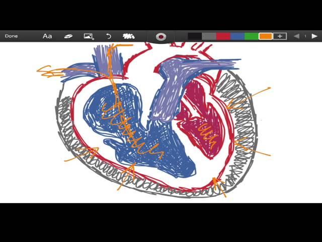 Beck's Triad - Cardiac Tamponade - EMTprep.com