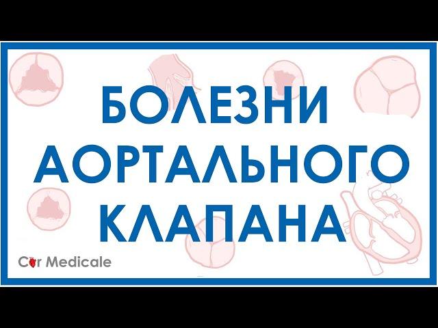 Болезни аортального клапана: аортальный стеноз, недостаточность аортального клапана.