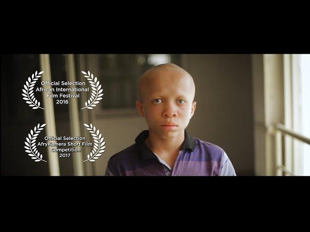 COLOURISM  ( A Short Documentary on Albinism)