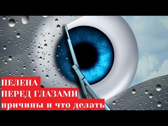 Туман (пелена) перед глазами  причины и лечение