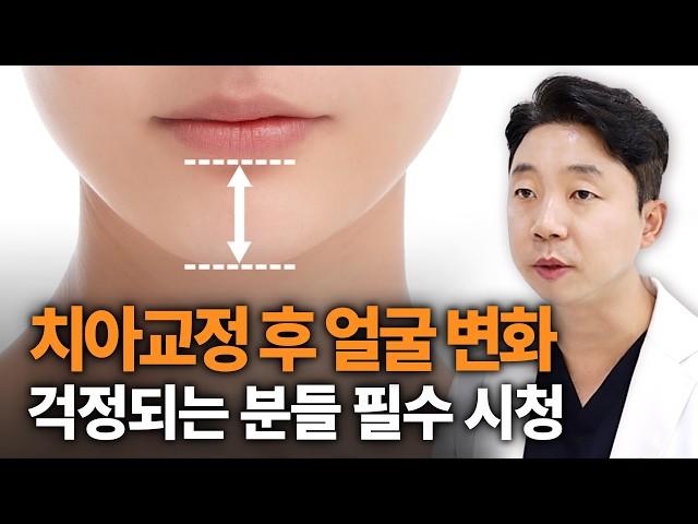 치아교정 후 얼굴변화? 교정후 턱이 길어지는 이유