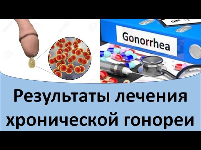 Результаты лечения хронической гонореи