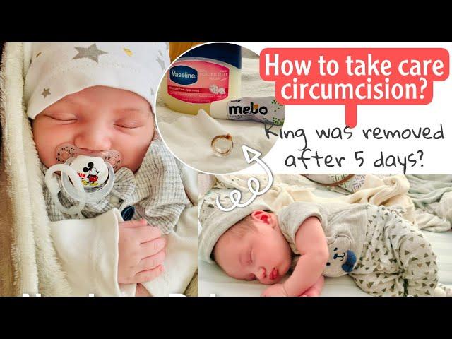 How to take care circumcision on newborn baby? / Sheryl Squad