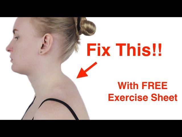 Easy Fix for the Neck Hump! (With FREE Exercise Sheet!)