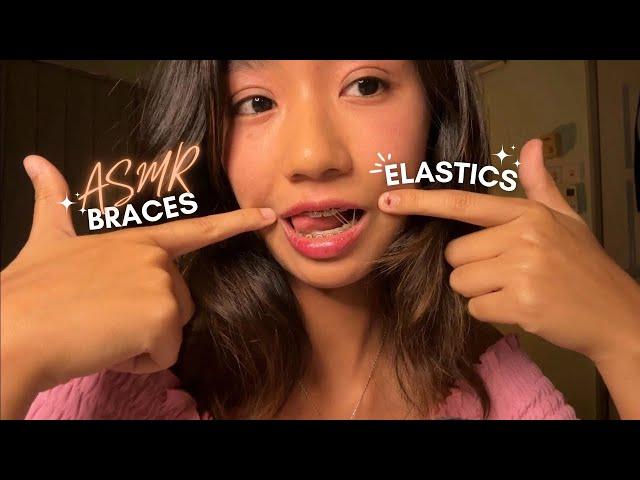 ASMR ~ MY LAST BRACES TAPPING WITH ELASTICS VIDEO