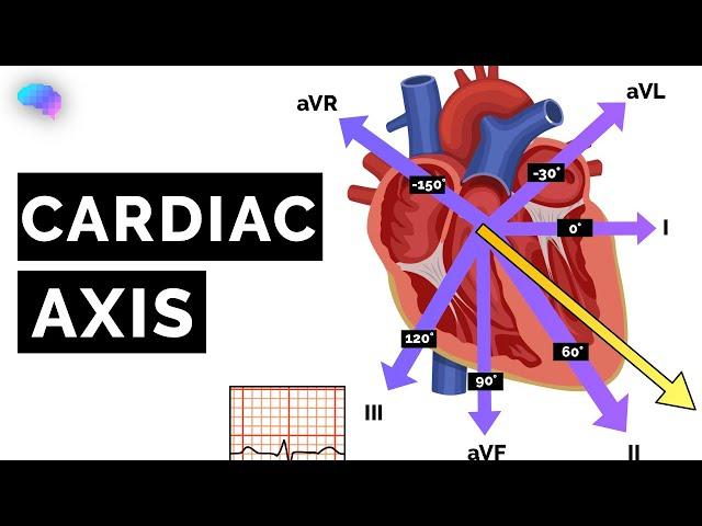 Cardiac Axis Explained | ECG | EKG | OSCE Guide | UKMLA | CPSA