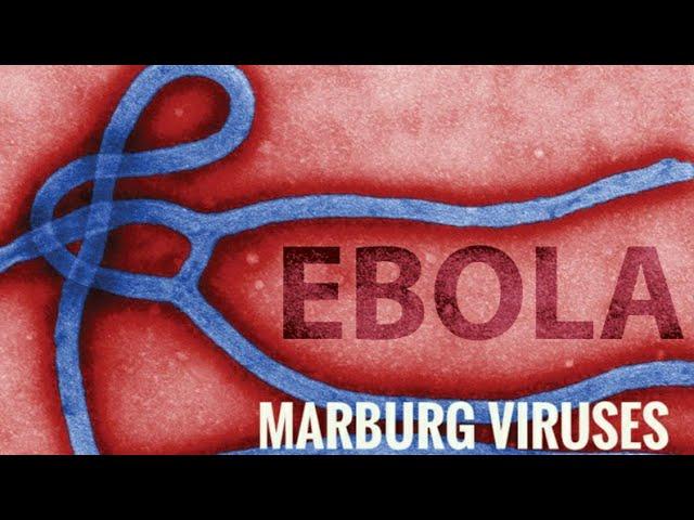 Ebola and  Marburg viruses - causes,clinical manifestations, diagnosis, treatment and prevention.