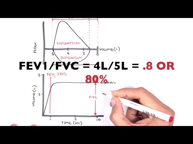 Understanding Spirometry - Normal, Obstructive vs Restrictive