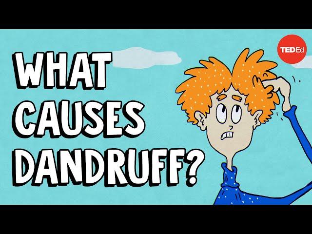 What causes dandruff, and how do you get rid of it? - Thomas L. Dawson