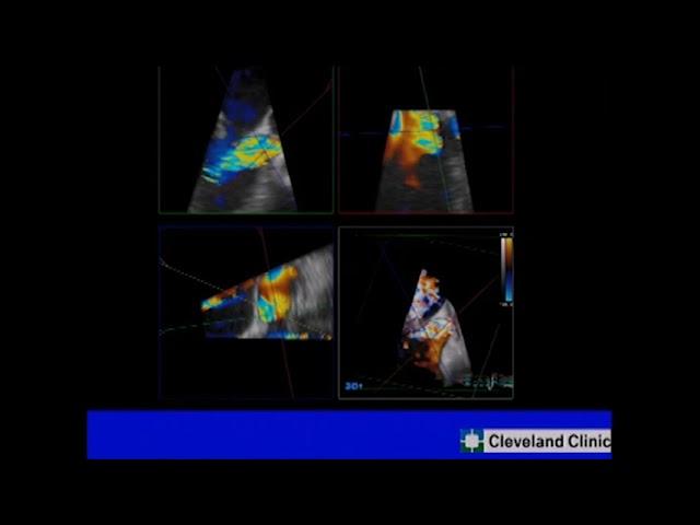 Valve imaging course- 3-1