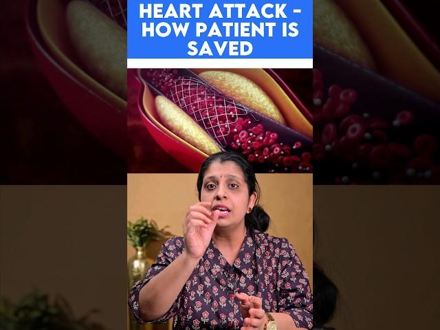 Heart attack - how patient is saved