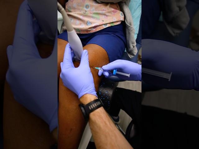How to alleviate chronic knee pain? #kneepain #painrelief #painmanagement #arthritis