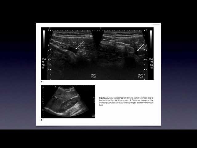 Ultrasound Article Review Nov 2012