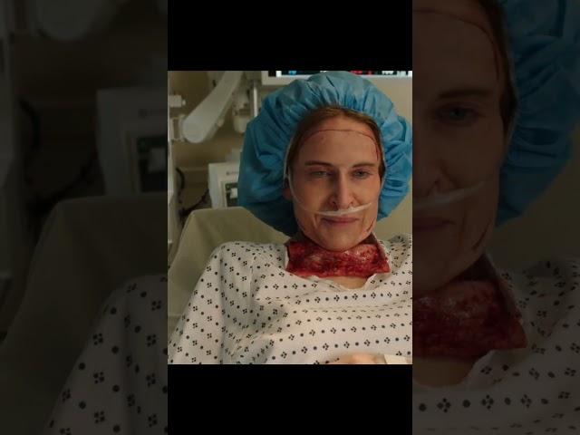 After the operation she saw this!