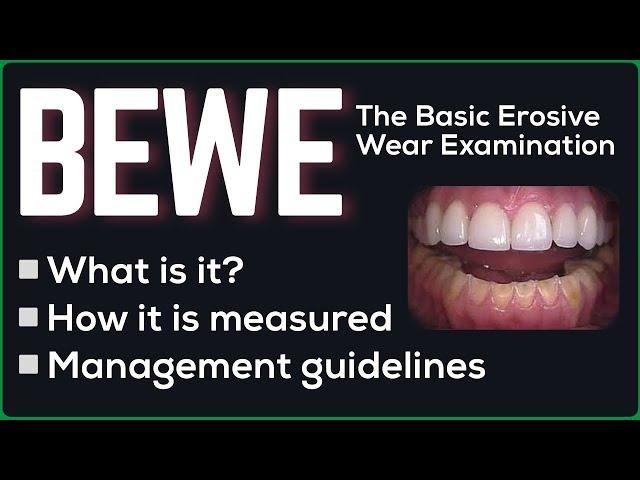 BEWE - The Basic Erosive Wear Examination explained