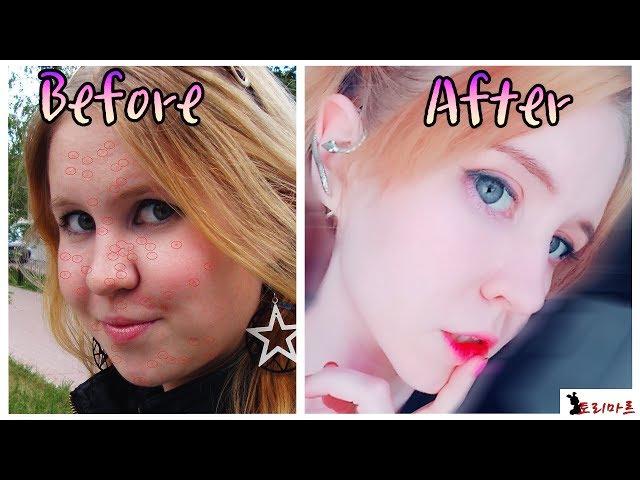 PERFECT SKIN | How to improve skin condition | ToRi MaRtini