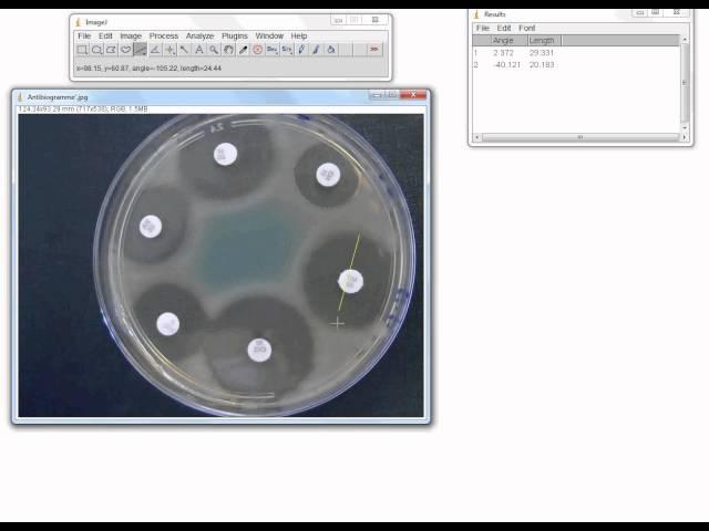 ImageJ ex3 diamètre d'inhibition