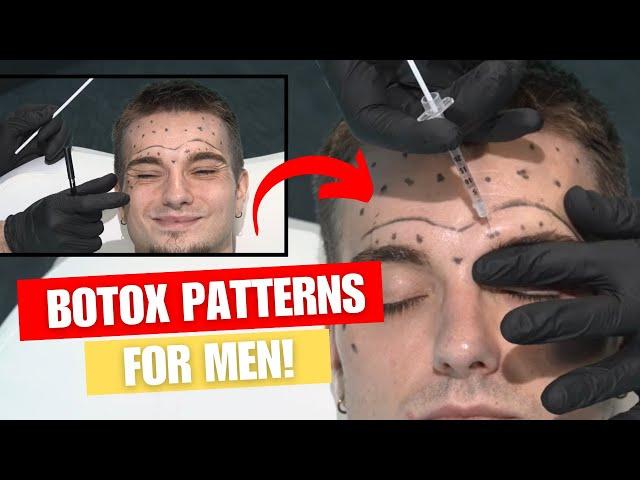 Male Botox Patterns & Injection Tutorial with 3D Anatomy!