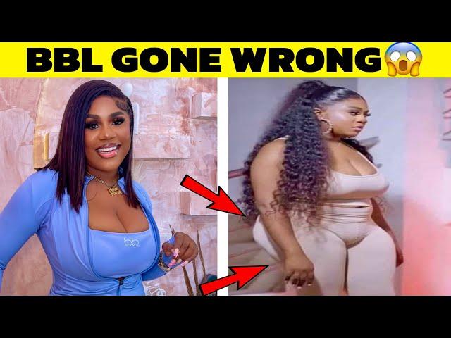 Top Nollywood Actresses Plastic Surgery Gone Wrong!