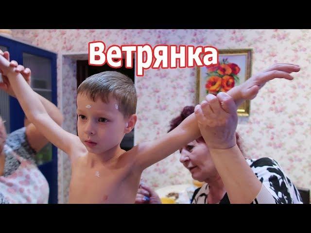 VLOG: У Клима ветрянка, у Вовы тоже?