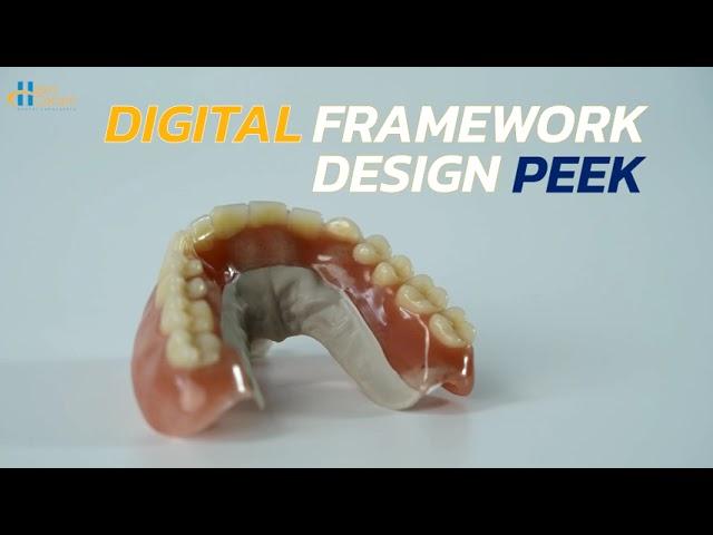 CAD/CAM Removable Denture