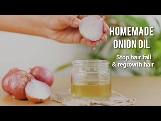 Homemade onion hair oil  for faster hair growth&stop hair fall /Diy onion hair oil #onionhairoil