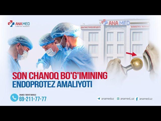 ANAMED tibbiyot markazida son-chanoq  bo'gimini endoprotezlash amaliyoti amalga oshirish boshlandi!