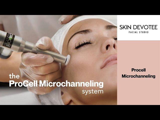 Procell Microchanneling Facial