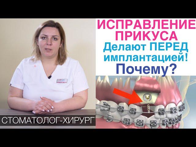 Пришел поставить зубные импланты, а мне сказали предварительно исправить прикус брекетами. Зачем?