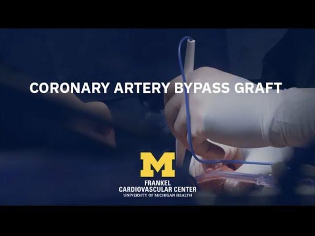 Cardiac Surgery Simplified: Coronary Artery Bypass Graft