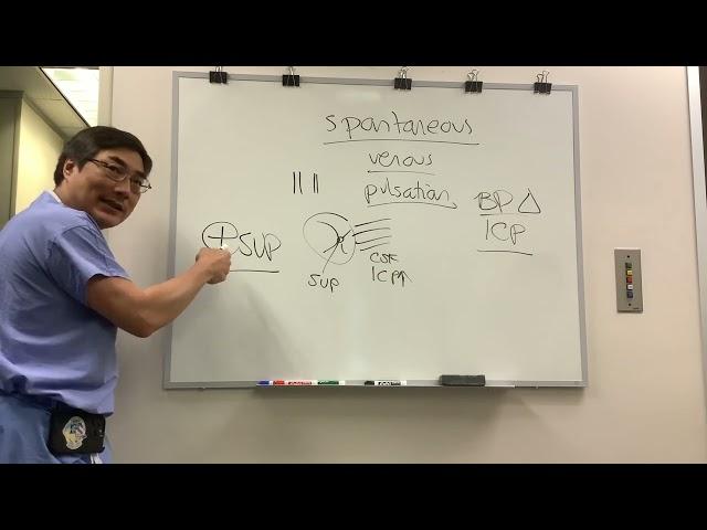 Spontanous venous pulsation in papilledema