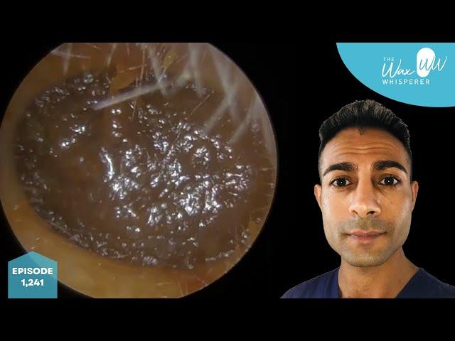 1,241 - Microsuction & Mechanical Ear Wax Removal