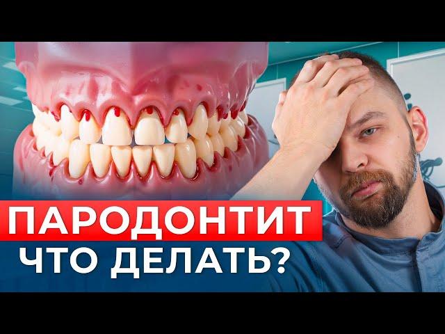 Пародонтит: как лечить и что делать?