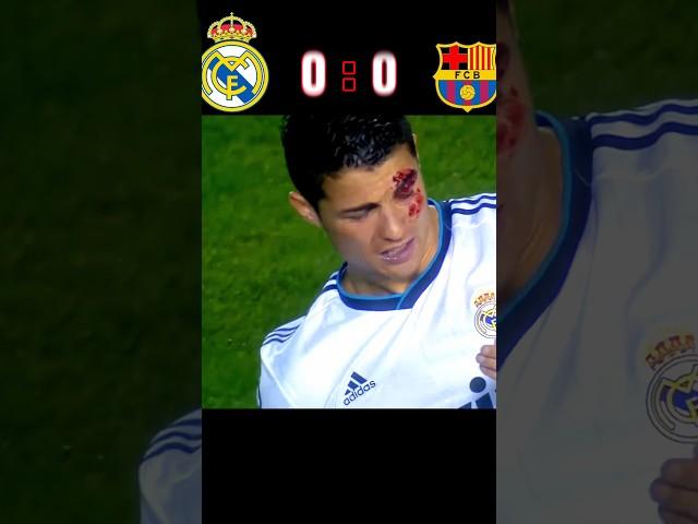 Teen Ager Messi & Ronaldo Injured  Real Madrid ️ Barcelona 3-2 Imaginary match #youtube #shorts