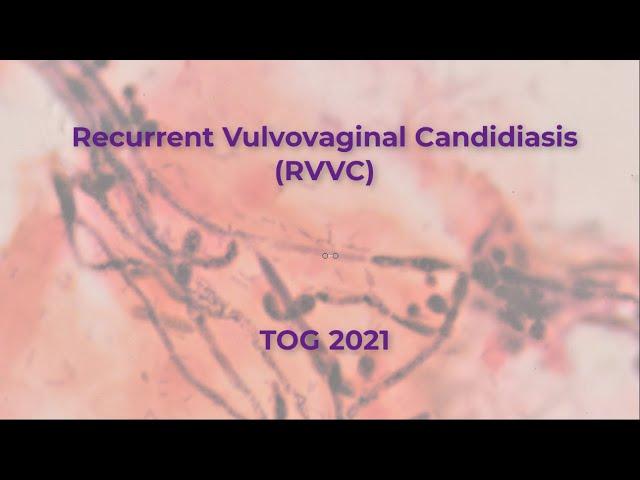 Recurrent vulvovaginal candidiasis -TOG 2021