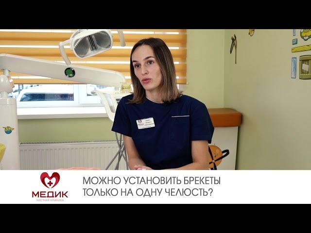 Можно установить брекеты только на одну челюсть?