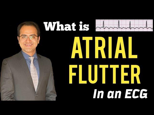 Atrial Flutter ECG Explained, Practice ECG's, Treatment, Symptoms, ECG Interpretation Lecture, USMLE