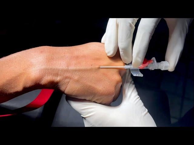 تعليم تركيب الكانيولا للمبتدئين (شرح عملي لتركيب الكانيولا)_How to Insert IV Cannula