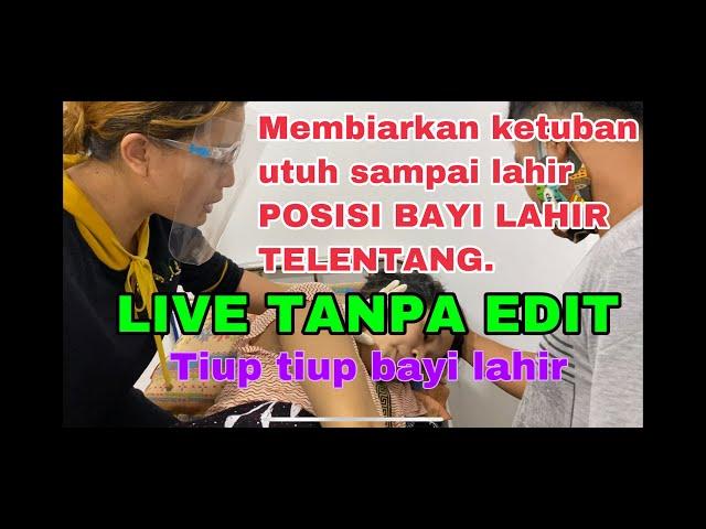 Posisi bayi keluar telentang dengan mudah, kontraksi  sedikit. Say no INDUKSI. Tiup tiup !!