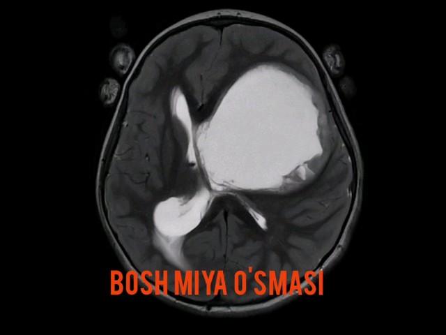 Bosh miya o'smasi diagnostikasi. #o'sma #MRI #МРТ #Braintumor #cancer #рак #анизокория #брадикардия