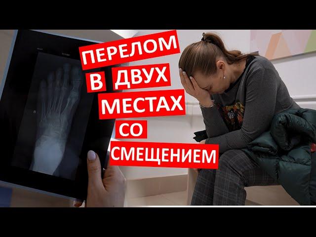 Vlog У меня перелом. Поехали в больницу. Больно. Сломала палец в двух местах со смещением. Плачу.