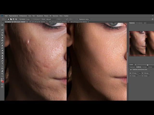 Retouching problem skin. Photographer Ekaterina Vetlovskaya