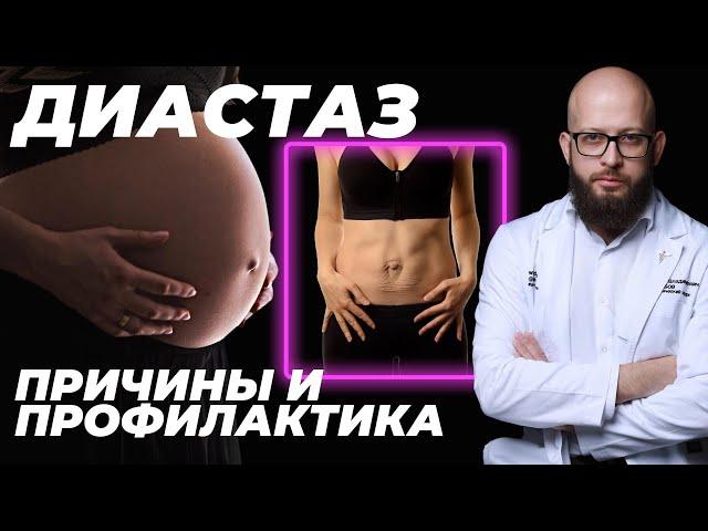 Причины расхождения мышц пресса после родов. Профилактика диастаза для беременных