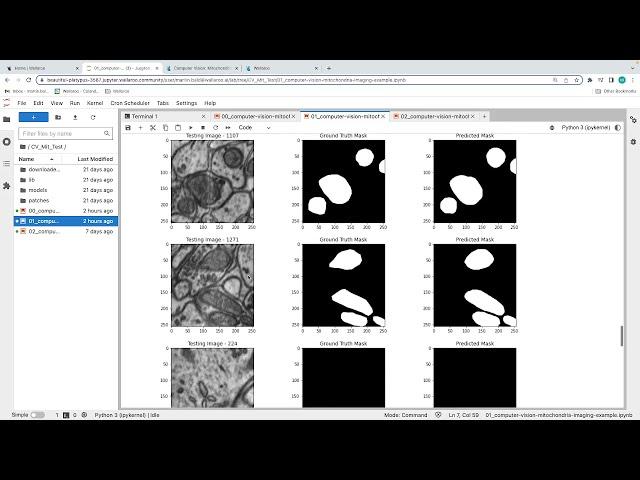 Computer Vision Models for Health Imaging Diagnostics Part 1